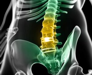Read more about the article Imaging for Low Back Pain